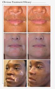 Emad Breadiy's Instagram, Twitter & Facebook