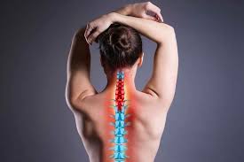 4) how to sleep with a thoracic herniated disc? Prolapsed Or Herniated Disc In The Neck Blackberry Clinic Blog