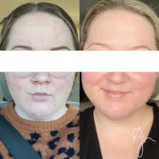 Robyn McCall, NWA holistic esthetician