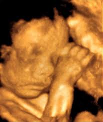 Ultrasound real 25 week fetus pictures. You Are 25 Weeks And 3 Days Pregnant Familyeducation