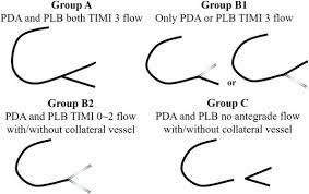 Influence About The Flow Of Distal Branch After Intervention