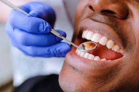 How Long Do Mini Dental Implants Take To Heal Advanced Dentistry Of Walnut Creek Walnut Creek California