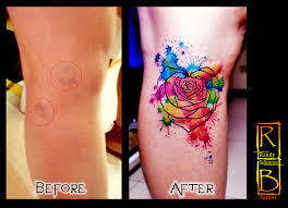 There are many products on the market designed specifically for covering up tattoos. Varicose Vein Cover Up Watercolor Tattoo