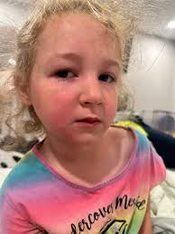 Can you identify the difference between poison oak and ivy?