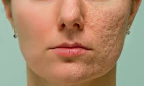 We did not find results for: Uneven Skin Tone Ozmedica Aesthetic Clinic Melbourne