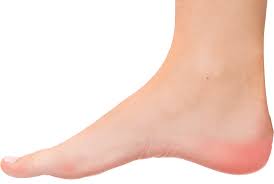 Foot is singular and feet is plural. Wichita Plantar Fasciitis Foot Pain Heel Pain Arch Support