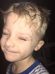 How to stop a 3-month-old Golden Retriever puppy from touching faces with  paws?