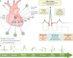 Image result for Myocardial Infarction Stabilization