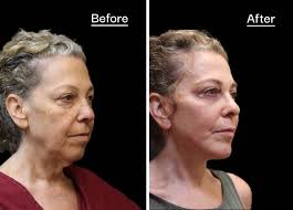 Plastic Surgery & Dermatology of NYC