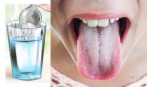 Pin On Home Remedies
