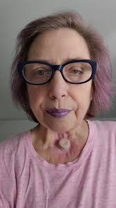 Shaye Scott Vocal Surgery