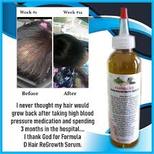 How do you use jamaican castor oil for hair growth? Hair Oil Formula D Hair Regrowth Serum For Fast Hair Growth Dht Blocker For Men And Women With Jamaican Black Castor Oil