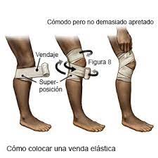 Distension De La Ingle Aftercare Instructions Care Guide Information En Espanol