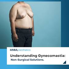 Image result for Gynecomastia