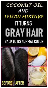 New Questions About Baking Soda To Grow Hair Answered And Why You Must Read Every Word Of This Report Healthy Medicine Tips In 2020 Reverse Gray Hair Grey Hair Remedies