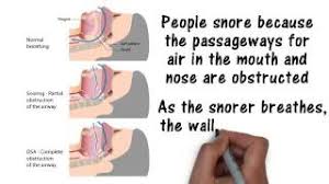Marketingtracer seo dashboard, created for webmasters and agencies. 5 Answert To Anti Snoring Devices Shoppers Drug Mart