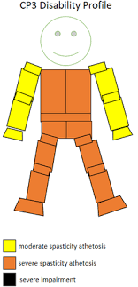 Tokyo 2020 paralympics opening ceremony thoughts (self.olympics). T33 Classification Wikipedia