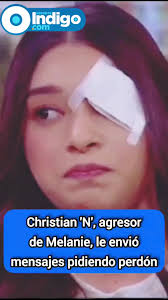 Melanie Barragán revela mensajes donde su agresor Christian 'N' le pide lo  perdone, después de los hechos violentos que le costaron a la joven  lesiones graves en su rostro.
