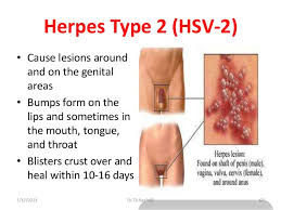 But if left untreated these infections can have a serious effect on a person's life. Sexually Transmitted Infections