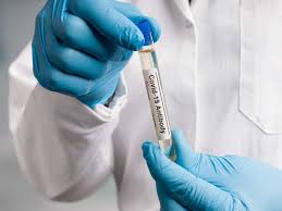 Now you will be able to check it soon through the top tools to check status of corona vaccine. Coronavirus Vaccine Do You Need An Antibody Test After Getting Vaccinated The Times Of India