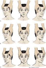 Image result for Oculovestibular Testing