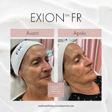 Annie Lapointe Médico...