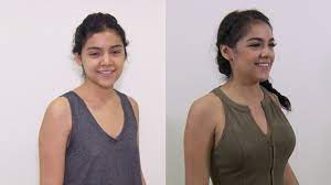 Teen Gets Breast Implants to Start Freshman Year of College - YouTube
