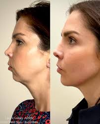 Laura Lakey (@laurainavondale) • Instagram photos and videos