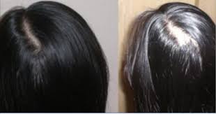 أناقة مغربية خلطة لملء فراغات الشعر في رأسك Hair Care Long Hair Styles Hair