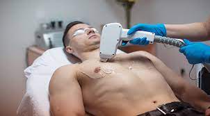 The complete laser hair removal process requires a series of treatments, but results can be seen after the first treatment. How Long Does Laser Hair Removal Last Spa810