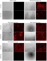 Vero cells are derived from the kidney of an african green monkey, and are one of the more commonly used mammalian continuous cell lines in microbiology and molecular and cell biology research. Viruses Free Full Text Evolution Of Attenuation And Risk Of Reversal In Peste Des Petits Ruminants Vaccine Strain Nigeria 75 1 Html
