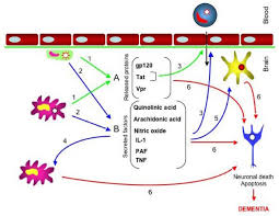 Image result for AIDS Dementia Complex