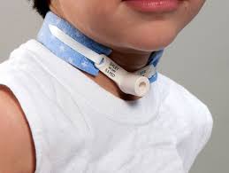 Youth Size Tracheostomy Neckband