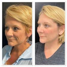 Beauty & Grace Aesthetics, 93 S 9th St, Noblesville, IN 46060, US