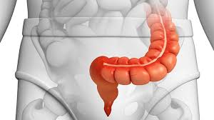 For other uses, see colon. How Diverticulitis Affects The Sigmoid Colon Everyday Health