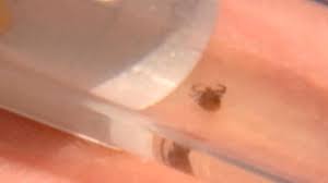Connect with tickcheck on facebook for the latest tick news and tips! Protecting Yourself And Your Dog During The Height Of Tick Season In Oregon Local News Kptv Com