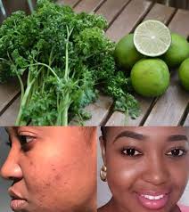 En captant certains composés sulfurés à en hydrolat: 20 Astuces Avec Le Persil Que Toutes Les Femmes Doivent Connaitre Astuces Pour Tous