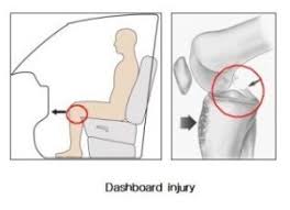 The dashboard will allow qualified users to perform detailed queries of their institutional data and. Posterior Cruciate Ligament Personal Trainer London