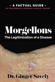 Treating other medical or psychiatric problems morgellons disease complications. Amazon Com Morgellons The Legitimization Of A Disease A Factual Guide By The World S Leading Clinical Expert Ebook Savely Ginger Kindle Store