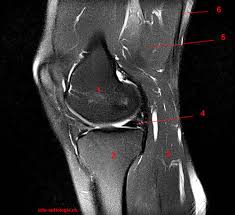 The knee joint is the junction of the thigh and leg. Atlas Of Knee Mri Anatomy W Radiology