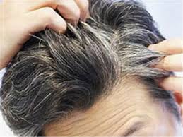 I highly recommend that you massage the blackstrap molasses into your hair. Ayurvedic Remedies For Grey Hair