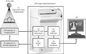 Dr flat panel detector model: Digital Radiography An Overview Springerlink