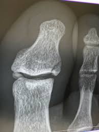 はっとり整骨院