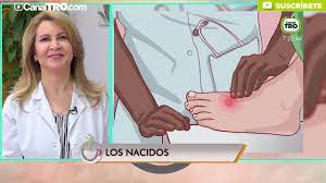 La Aparicion De Los Nacidos En La Piel Youtube
