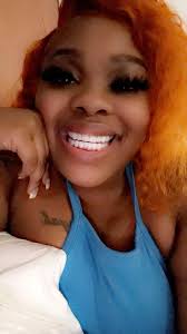 Porcelain Veneers at Miami Cosmetic Smile Design