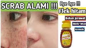 Maybe you would like to learn more about one of these? Cara Menghilangkan Flek Hitam Noda Hitam Komedo Bekas Jerawat Dengan Scrab Bahan Alami Dian W Sari Youtube