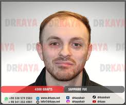 Sayın Andrew Clark Shepard'ın 12 aydaki sonucunu ve süreç boyunca  gelişimini sola kaydırarak görebilirsiniz.