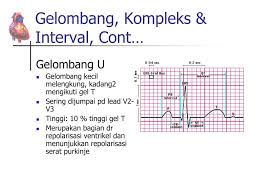 Elektrokardiogram (ekg) adalah representasi dari suatu sinyal yang dihasilkan oleh aktifitas listrik otot jantung. Ppt Monitoring Ekg Powerpoint Presentation Free Download Id 3287061