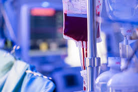Image result for Transfusion Associated Circulatory Overload