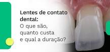 Lentes de contato dental: o que é, quanto custa e qual a ...